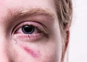 आंसू क्या होता है? और रोने में आंसू क्यों निकलते हैं